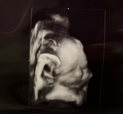 Ultrasound June 1, 2026